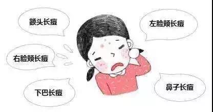 脸上有痘痘粉刺的肌肤 脸上有痘痘粉刺的肌肤